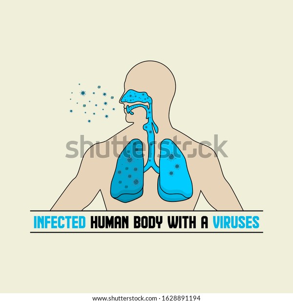 Infected human respiratory tract vector\
Illustration for template\
design