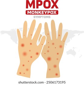 Infected person's hands with Mpox monkeypox virus. Illustration of visible rash and red lesions symptoms of the Monkeypox virus.