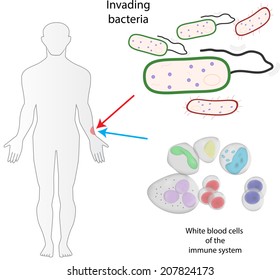 Infection Healing
