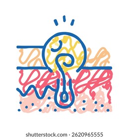 infection from ingrown hair doodle icon sketch vector. infection from ingrown hair sign. isolated symbol illustration