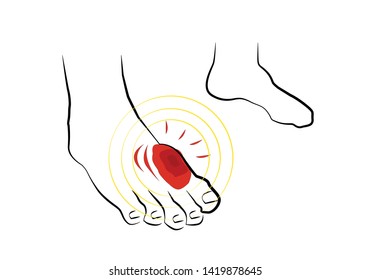 Infection, Pain Or Punctured Wound With Blood On A Feet. Gout Or Arthritis Concept. Editable Clip Art. 