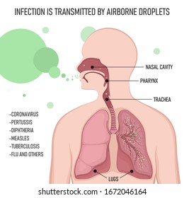 Infection is transmitted by airborne droplets. Human body with lungs affected by virus cells through the respiratory tract.