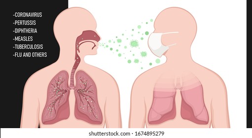 Infection is transmitted by airborne droplets. Мan wears a protective mask. Protection against virus. The spread of coronavirus, tuberculosis, influenza and other