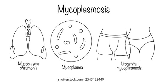 Enfermedad infecciosa causada por microorganismos del género Mycoplasma. Micoplasmosis respiratoria dibujada a mano y micoplasmosis genitourinaria y el agente causal de la enfermedad. Ilustración vectorial