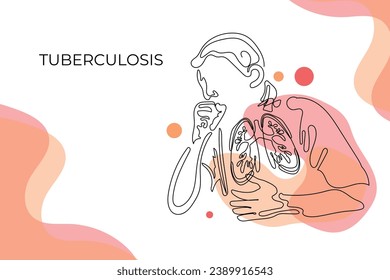 
Infizierte Lungenwachstumskunst. Tuberkulose Pneumonie. Vektorgrafik