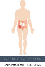 Inflamed Appendix Icon Vector Illustration.