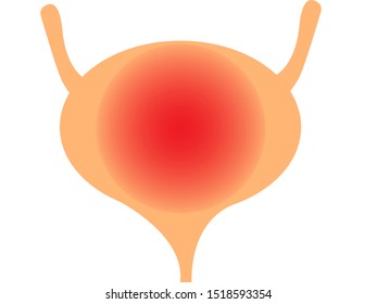 Inflamed bladder isolated on a white background.