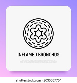 Inflamed bronchus thin line icon. Symptom of asthma. Modern vector illustration.