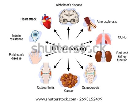 Inflammaging. Chronic sterile low-grade inflammation. Aging process. inflammation that develops with advanced age. Vector illustration
