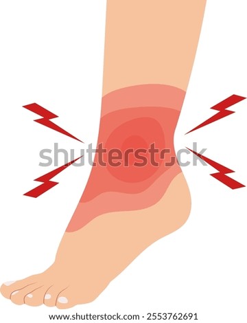 Inflammation Ankle Joint Foot Illustration Isolated on White Background