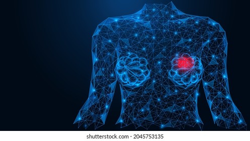 Inflammation of the breast in women. Female breasts with signs of the disease. A low-poly construction of interconnected lines and points. Blue background.