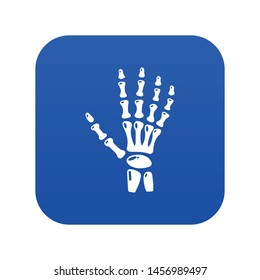 Inflammation of hand icon. Simple illustration of inflammation of hand vector icon for web.