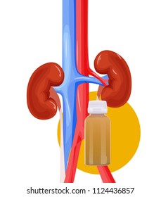 Inflammation of the kidney human urinary organs, heart, kidney, bladder vector illustration