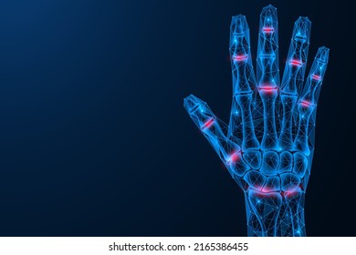 Inflammation and pain in the joints of the hand. Polygonal design of interconnected lines and points. Blue background.