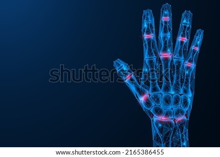 Inflammation and pain in the joints of the hand. Polygonal design of interconnected lines and points. Blue background.