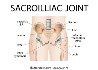 Inflammation of the sacroiliac joint of the lower back, arthritis 3d medical tissue illustration