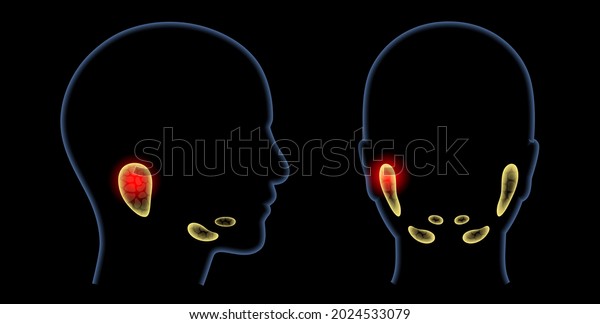 Inflammation of a salivary glands in human\
mouth. Parotid, submandibular, and sublingual gland. Produce of\
saliva through a system of ducts. Xerostomia oral disease. Medical\
3d vector\
illustration.