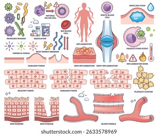 La respuesta inflamatoria muestra células inmunitarias, articulaciones inflamadas y daño tisular, ilustrando los mecanismos de defensa del cuerpo. Colección de estilo de esquema
