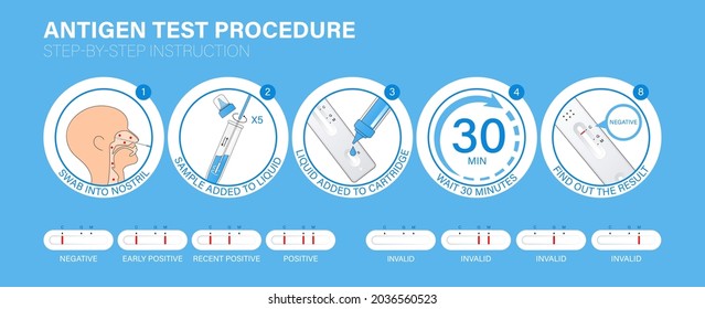 Influenza, COVID-19 Antigen Schnelltest Verfahren Infografik. Schritt-für-Schritt-Anleitung zur Funktionsweise von Tests