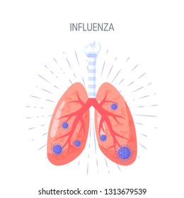 Influenza lung disease concept. Vector illustration in flat style for medical atlases, articles, infographics etc.