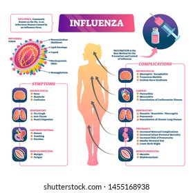 Influenza vector illustration. Labeled flu symptoms, prevention and complication scheme. Diagram with educational virus cell closeup and structure graphic. Microbiological bacteria disease and illness