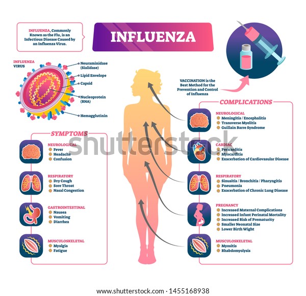 Influenza Vector Illustration Labeled Flu Symptoms Science