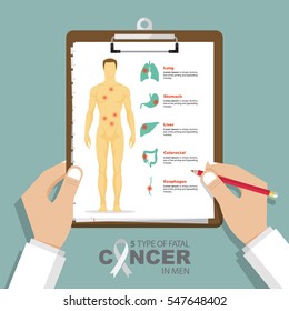 Infographic for 5 type of fatal cancer in men in flat design. Clipboard in doctor hand. Medical report. Vector Illustration. 