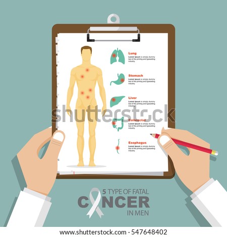 Infographic for 5 type of fatal cancer in men in flat design. Clipboard in doctor hand. Medical report. Vector Illustration. 