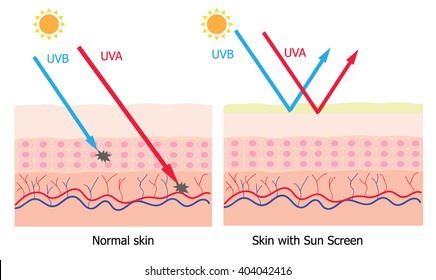 Infographic about sunscreen lotion protect human skin from UVA , UVB ray 