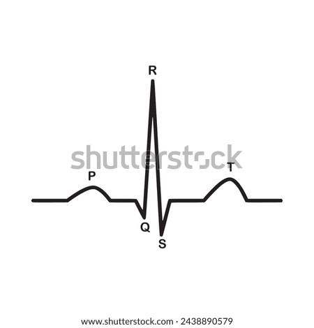 infographic. Diagram of normal sinus rhythm as seen on ECG. In atrial fibrillation the P waves, which represent depolarization of the top of the heart, are absent. illustration vector design science