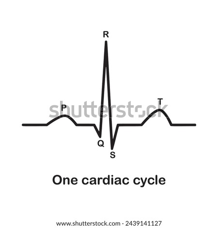 infographic. Diagram of normal sinus rhythm as seen on ECG. In atrial fibrillation the P waves, which represent depolarization of the top of the heart, are absent. illustration vector design science