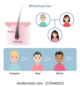 Infografik von grauem Haar, Vektorgrafik einzeln auf weißem Hintergrund. Der Mechanismus des Haargrauens. Das kann von den Eltern geerbt werden und fängt an, grau zu sein variiert von Rasse zu Rasse. 