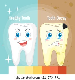 Infographic of healthy tooth and tooth decay illustration