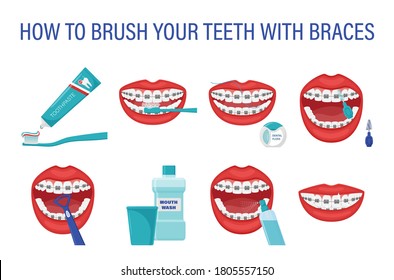 Infographic how to brush your teeth with braces. Step-by-step instructions. Oral hygiene. Healthy lifestyle and dental care. Clean white teeth. Prevention of caries. Isolated flat vector illustration