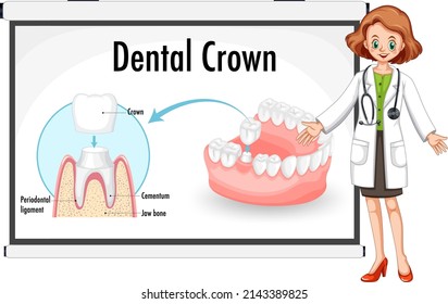 Infographic Human Dental Crown Illustration Stock Vector (Royalty Free ...