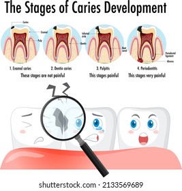 Infographic of human in stages of caries development illustration