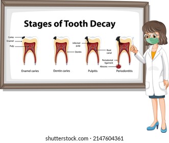 Infographic of human in the stages of tooth decay illustration