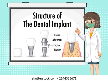 Infographic of human in structure of the dental implant illustration