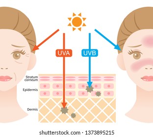 infographic illustration of difference between UVA and UVB rays. UV penetration into human skin and woman face. skin care and beauty concept