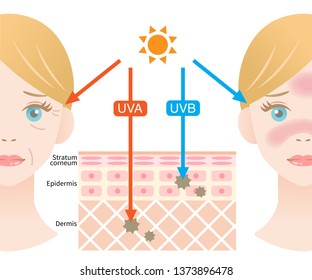 infographic illustration of difference between UVA and UVB rays.  UV penetration into human skin and white woman face. skin care and beauty concept