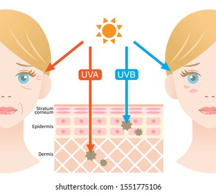 infographic illustration of difference between UVA and UVB rays. UV penetration into human skin and woman face. skin care concept