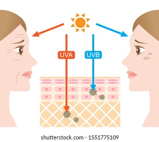 infographic illustration of difference between UVA and UVB rays. UV penetration into human skin and woman face. skin care concept