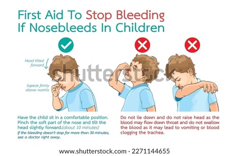 Infographic illustration of first aid to stop bleeding if nosebleeds in children,allergic rhinitis,respiratory diseases,nosebleeds from accidents,health care,medical concept in children,on white.