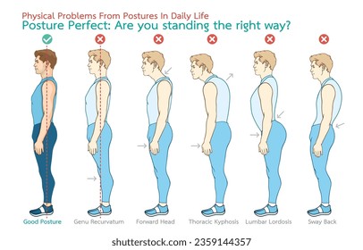 Ilustración infográfica de problemas físicos de posturas en la vida diaria, postura perfecta, ¿estás de pie en la dirección correcta?, aislado en blanco. Atención de salud, estilo de vida con buena personalidad, Evitando enfermedades.