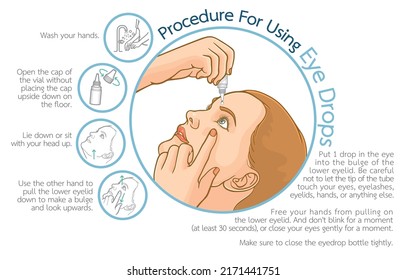 Ilustración infográfica del procedimiento para el uso de colirios o el uso correcto de colirios, aislados en el fondo blanco, Concepto de tratamiento ocular, inflamación ocular, fatiga ocular, cuidado de los ojos, salud y visión.