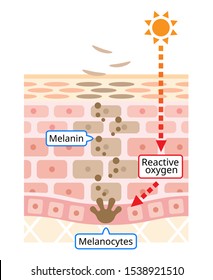 Infographic Illustration Of Skin Cell Turnover. Melanin And Melanocytes With Dark Soot