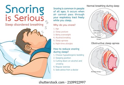 Infographic illustration of snoring is serious,sleep disordered breathing,overweight man snoring,increasing risk of health problems,isolated on white,Get healthy,quality sleep for long night concept.