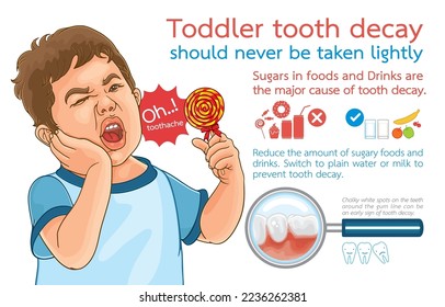 Infographic illustration of toddler tooth decay should never be taken lightly,sugars in foods and Drinks are major cause of tooth decay,on white.Oral health,Watch out for tooth decay in children.
