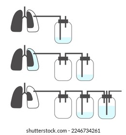 Infografik des Systems der intercostalen Entwässerung auf weißem Hintergrund