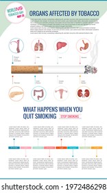 Infographic, organs affected by smoking and what happens over time when you stop smoking.